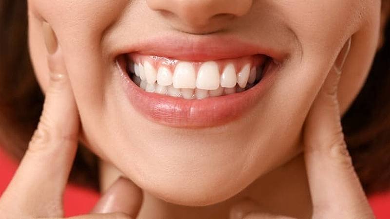 Top1 Singapore Dental Clinic