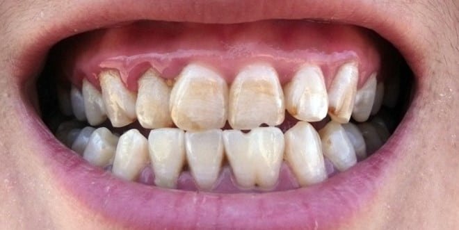 Best Yishun Dental Clinic